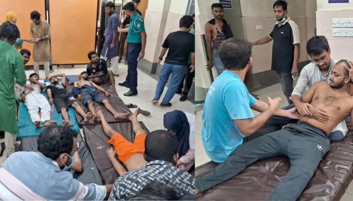 অর্ধশত শিক্ষার্থীর মাথায় অস্ত্রের কোপ অনেকের থেঁতলে গেছে হাত-পা অর্ধশত শিক্ষার্থীর মাথায় অস্ত্রের কোপ অনেকের থেঁতলে গেছে হাত-পা