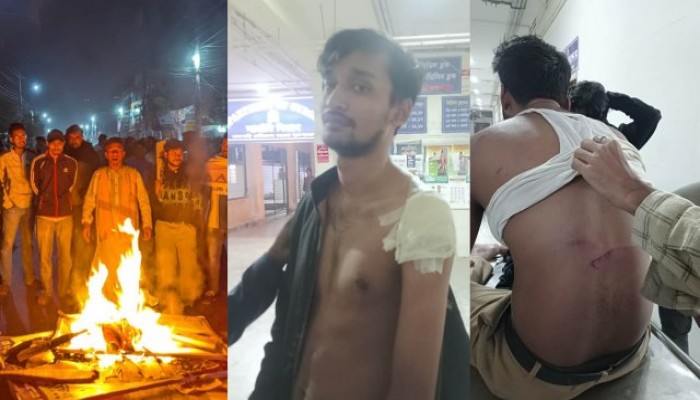 জুলাইয়ে ছাত্রলীগ থেকে পদত্যাগ করা ফারাবীসহ ৩ জনকে পিটিয়ে আহত